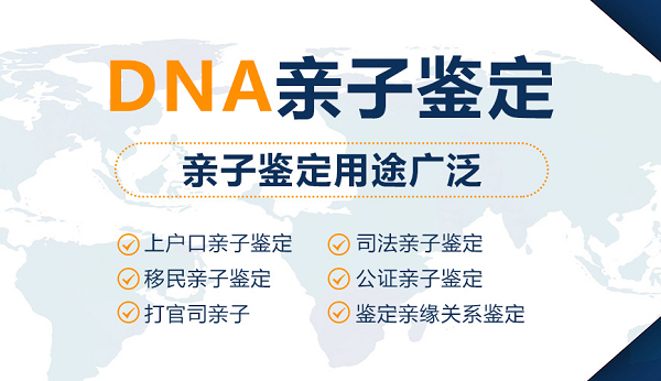 资阳司法DNA鉴定需要如何做,资阳司法DNA鉴定收费是多少钱